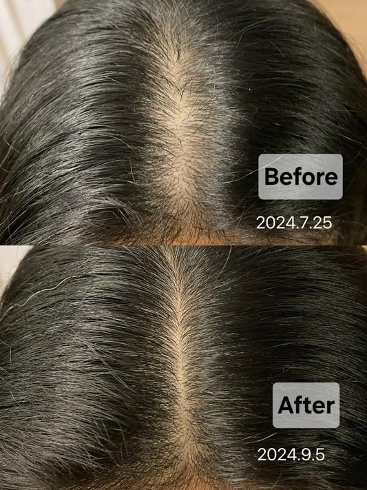 Botalab Deserticola Plus Shampoo, Conditioner & Oil Serum (3pc) - improve hair growth