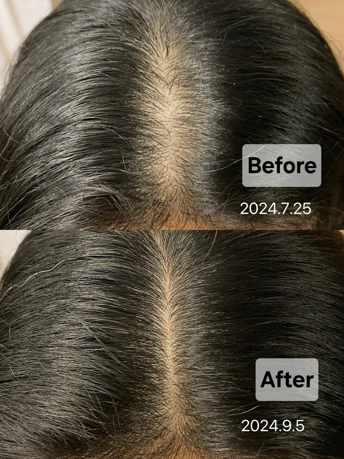 Botalab Deserticola Plus Shampoo, Conditioner & Oil Serum (3pc) - improve hair growth